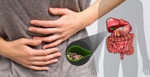 Gallstones Bladder specialist in Chandigarh