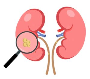 top urologist in Chandigarh