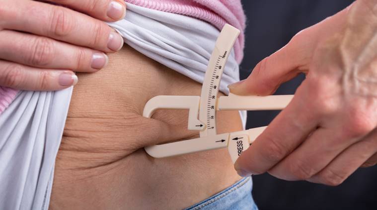 weight loss surgery in Chandigarh